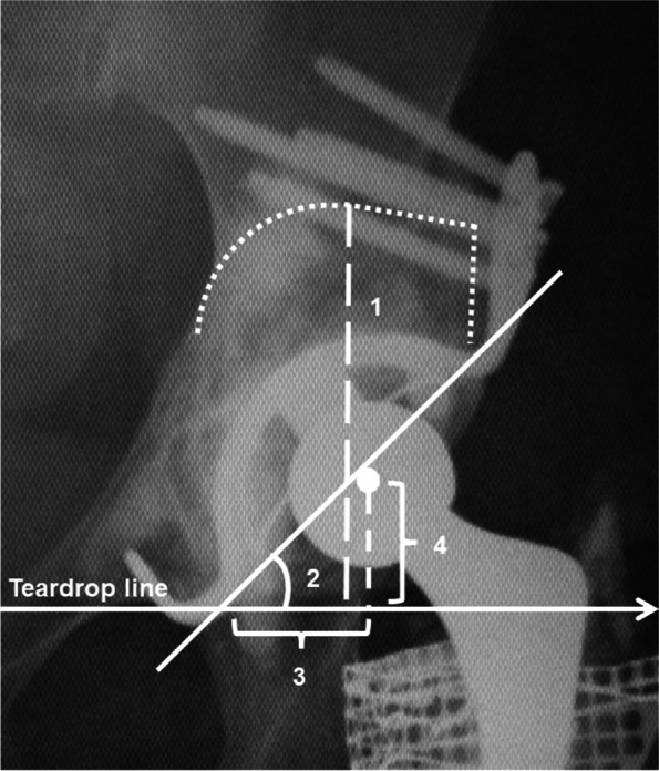 Fig. 1