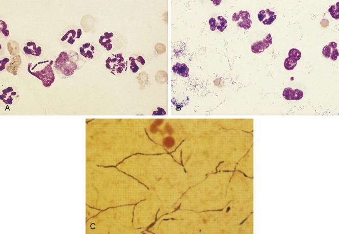 FIGURE 10-11