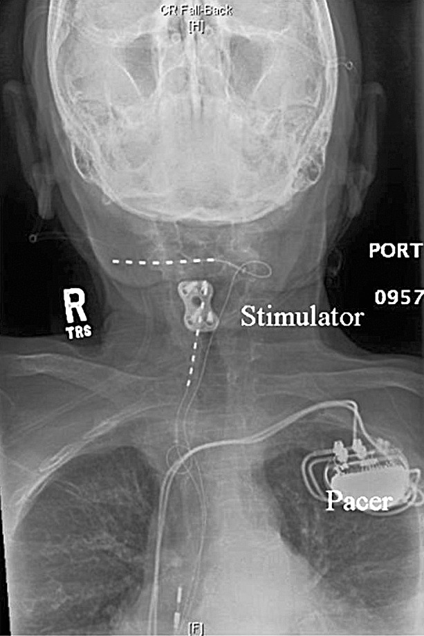 Figure 1.