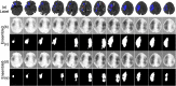 Fig 16