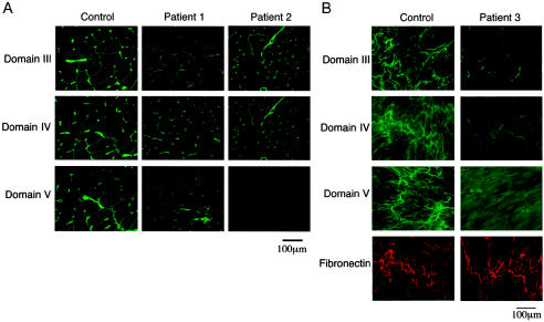 Figure  2