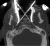 Fig. 1.