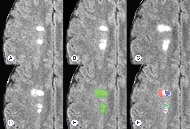 Fig 2.