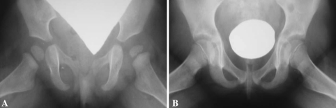 Fig. 1A–B