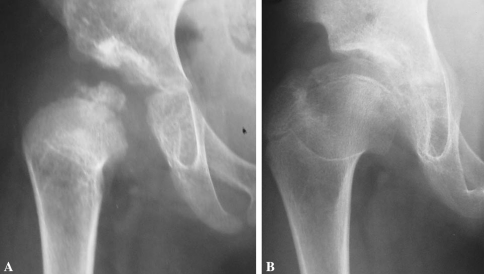 Fig. 3A–B