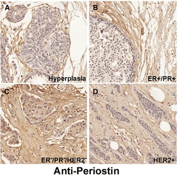 Loss of periostin/OSF-2 in ErbB2/Neu-driven tumors results in androgen ...