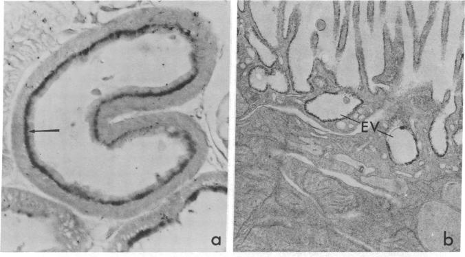 graphic file with name pnas00450-0163-a.jpg