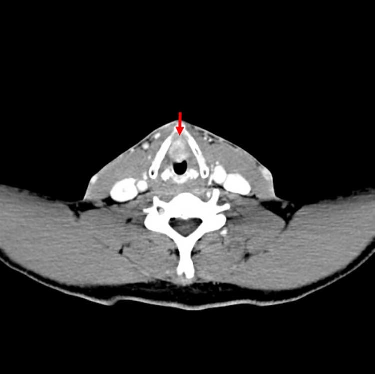 Fig. 1