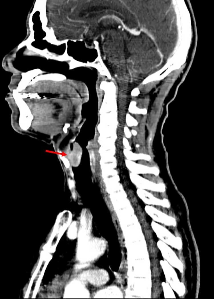 Fig. 3