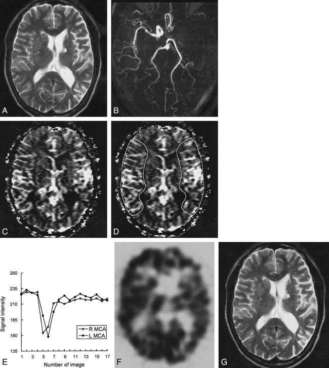 fig 2.