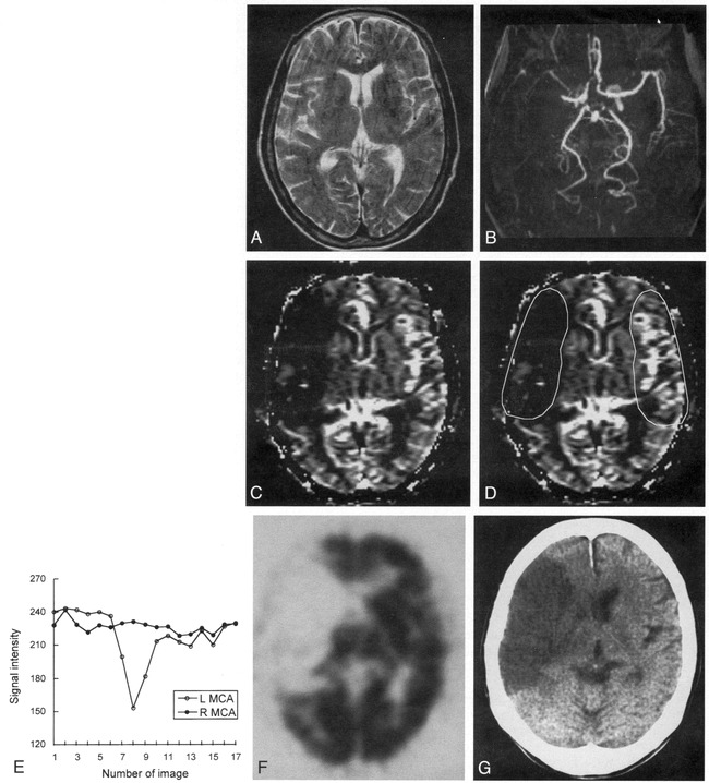 fig 1.