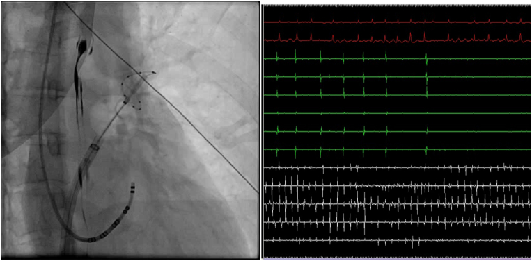 Fig. 4