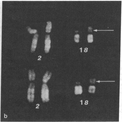 graphic file with name pnas00062-0341-a.jpg