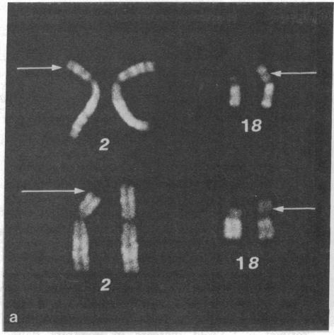 graphic file with name pnas00062-0341-b.jpg