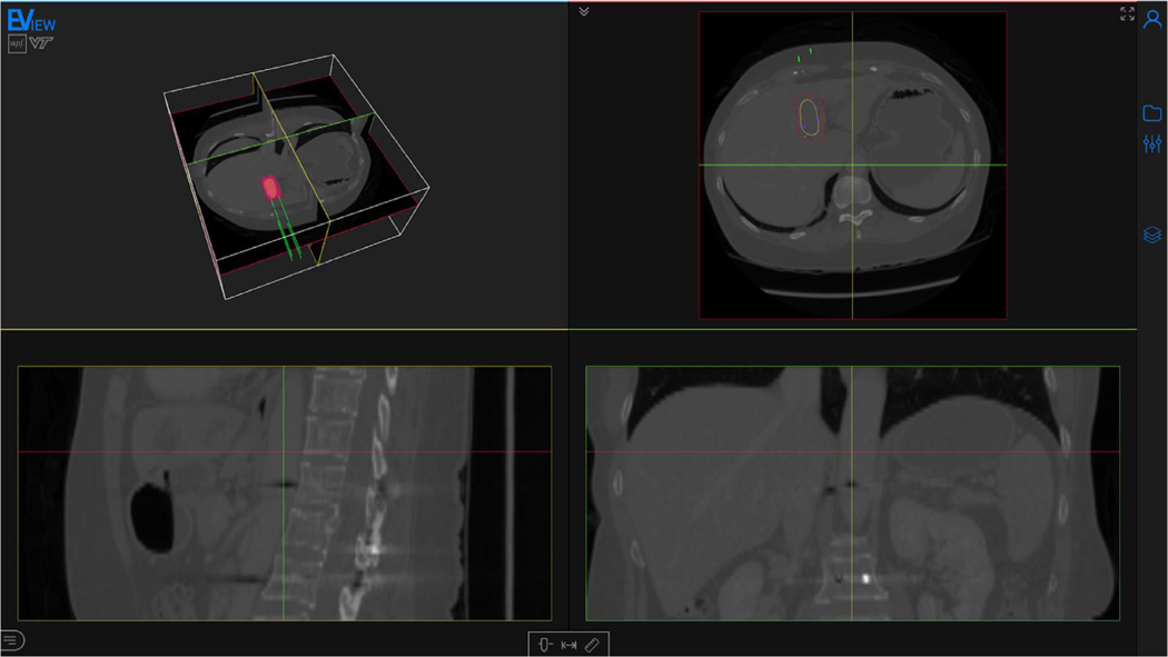 Fig. 2.