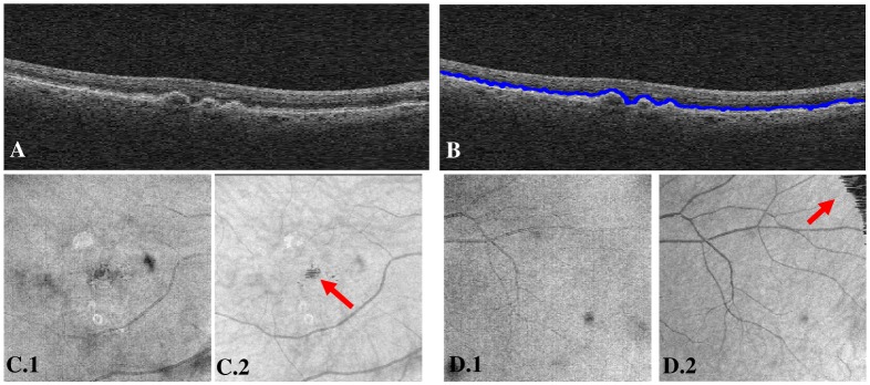 Fig. 2