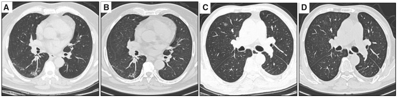 FIGURE 2