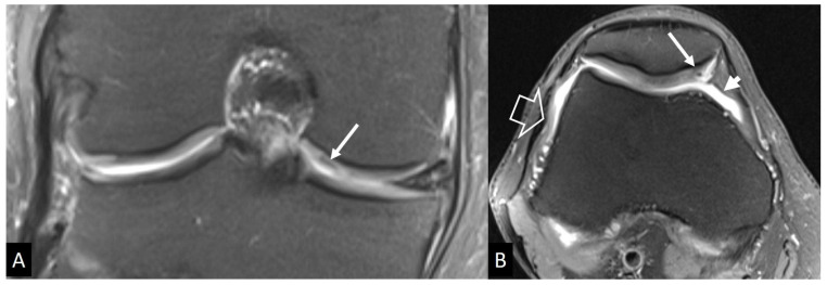 Figure 19