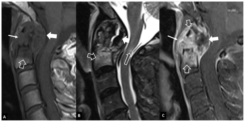 Figure 15