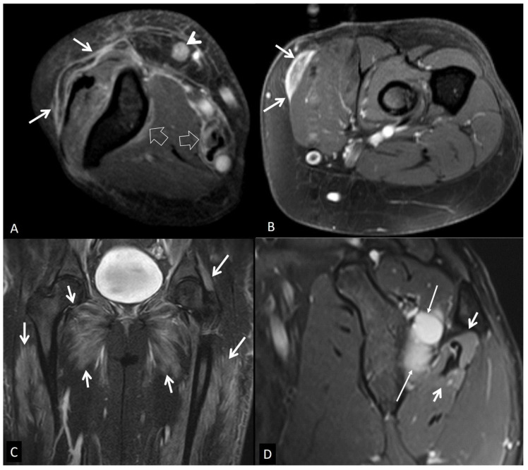 Figure 23