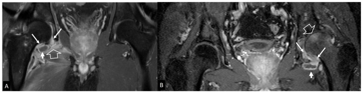 Figure 18