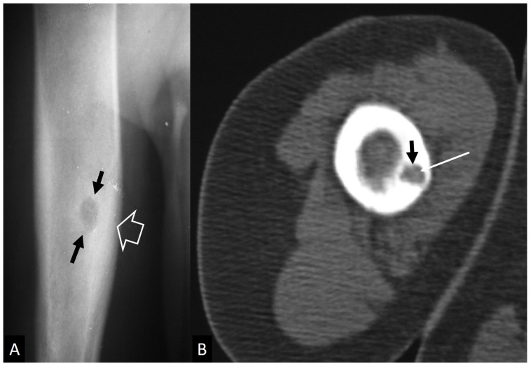 Figure 22