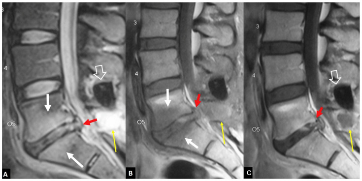 Figure 11