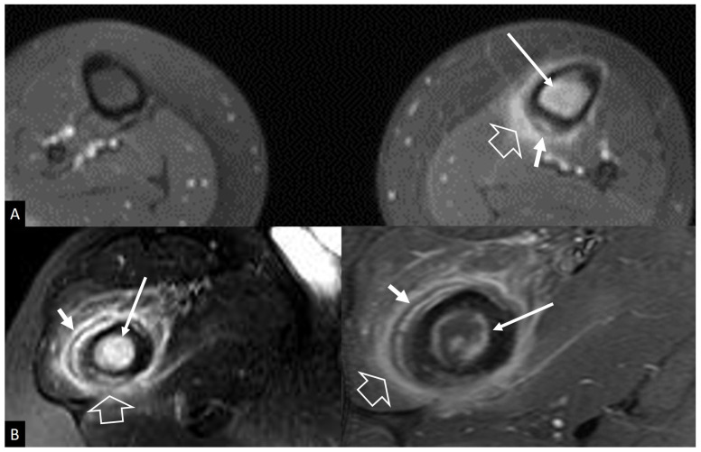 Figure 17