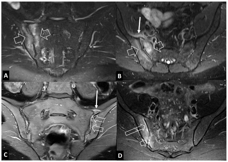 Figure 16