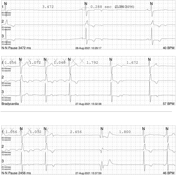 Supplemental Figure 1