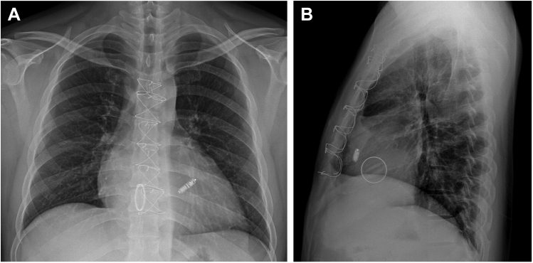 Figure 3