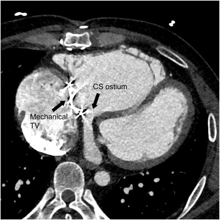 Figure 1