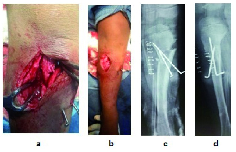 Figure 5. 