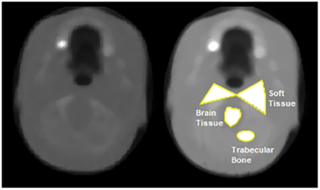 Fig. 2: