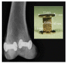 Fig. (1)
