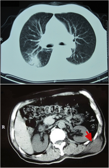 Fig. 2