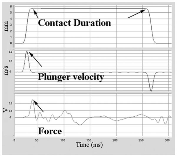 FIG. 3