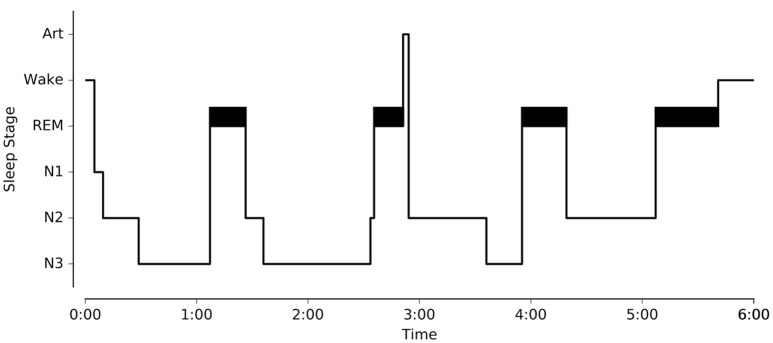 Sleep: An Open-Source Python Software for Visualization, Analysis, and ...