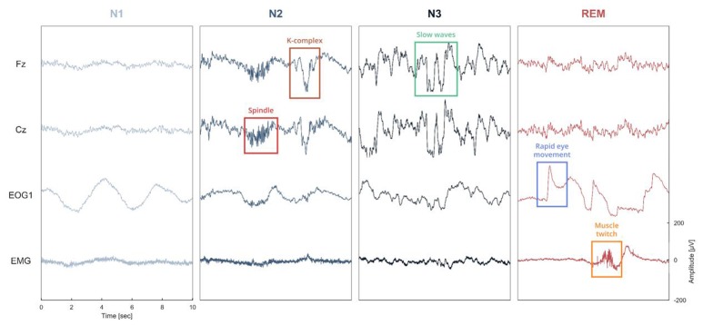 Sleep: An Open-Source Python Software for Visualization, Analysis, and ...