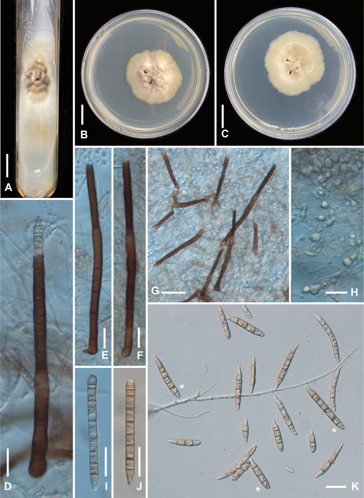 Fig. 3 - Ex-type cultures of Fusichalara pallida (BCRC-FU31906). A: Colony on a PDA slant developed from single-spore isolate. B: Colony on PDA plate (surface view). C: Colony on PDA plate (reverse side). D: A conidiophore showing a subsequent conidium emerging at the tip of the phialide. E, F: Conidiophores. G: Squashed mount showing conidiophores, conidia, and chlamydospores. H: Mycelium showing chlamydospore formation (monilioid hyphae). I, J: First-formed conidia. K: Conidia, first-formed conidia (indicated by asterisks) are cylindrical whereas subsequent conidia are fusiform. Bars: A−C 1 cm; D−F, H−K 20 µm; G 50 µm.