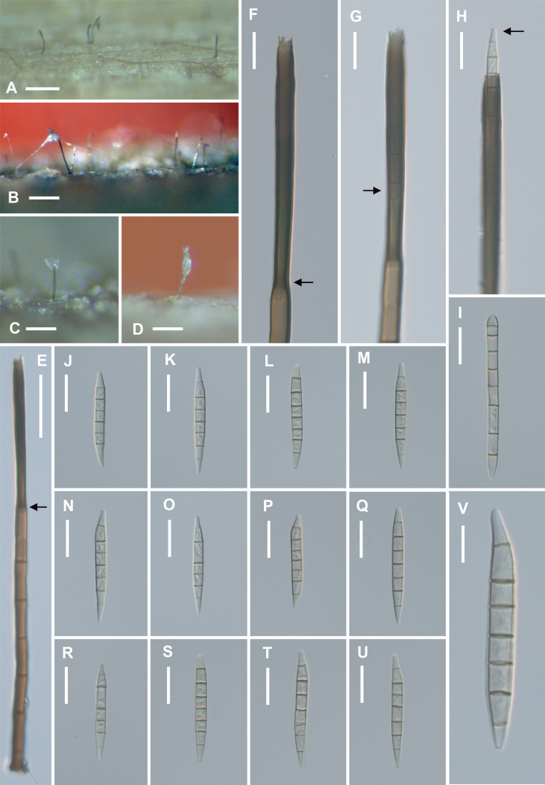 Fig. 2 - Fusichalara pallida (TNM F0037300, holotype). A, B: Colonies on natural substratum. C, D: Conidiophores on natural substratum, bearing a tuft of conidial mass at the apex. E: A conidiophore. Arrow indicates the point of transition from venter to the darker tubular collarette. F: Closer view of phialide. Note the pronounced wall-thickening (arrow) inside the phialide at the base of the tubular collarette. G: Closer view of phialide. Arrow indicates a conidium in the tubular collarette. H: Closer view of phialide showing a conidium emerging at the opening of the tubular collarette. Arrow points to the conically rounded conidial apex. I: A first-formed conidium which is cylindrical, with a rounded apex and an obconically truncate base. J-U: Subsequent conidia which are typically fusiform, 7-septate, and have paler end cells. Note that each conidium is conically rounded at the apex and obconically truncate at the base. V: Higher magnification of a subsequently formed conidium. Bars: A 500 µm; B-D 200 µm, E 50 µm; F-U 20 µm; V 10 µm.