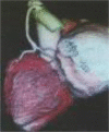 Fig. 10