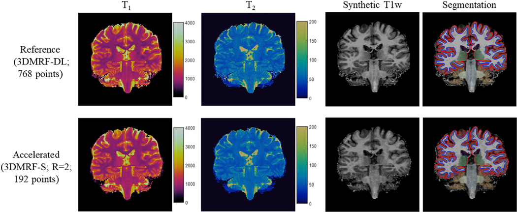 Fig. 10.