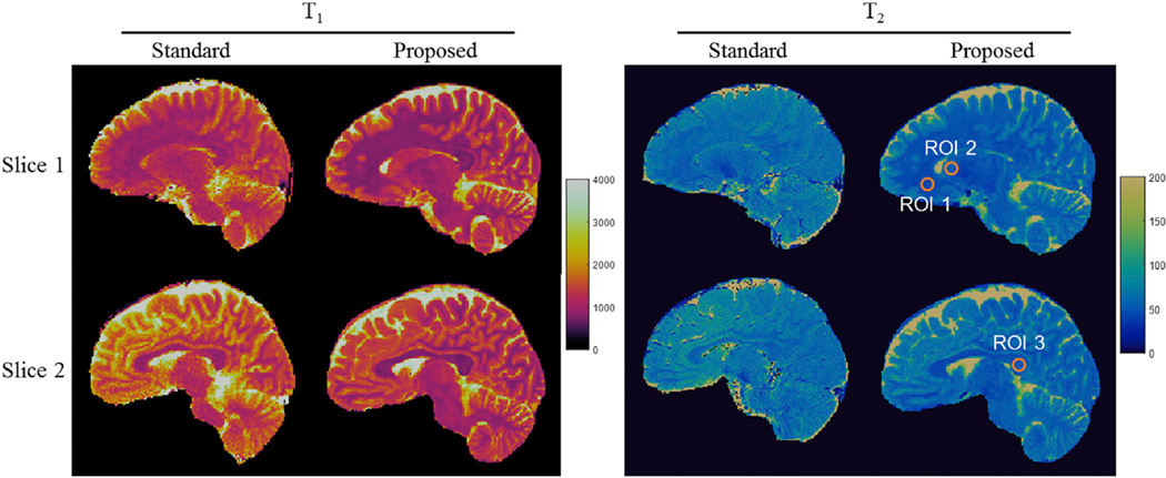 Fig. 11.