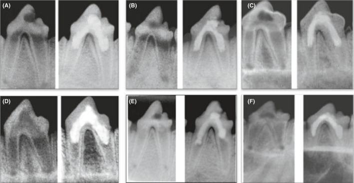 FIGURE 3