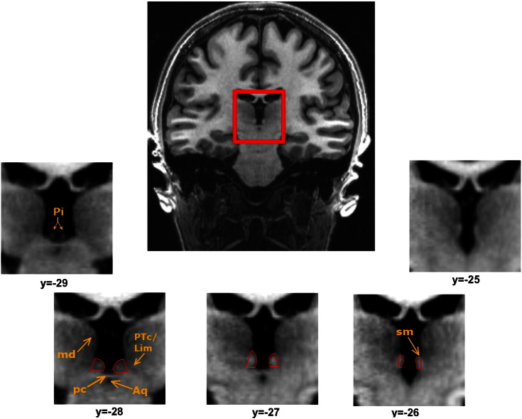 Fig. 1