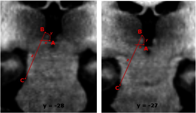 Fig. 2