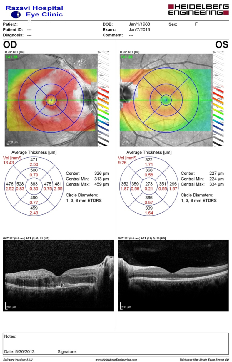 Fig. 2