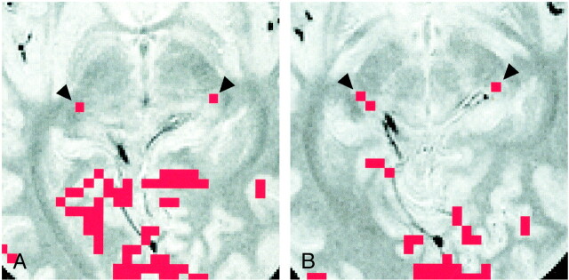 fig 3.