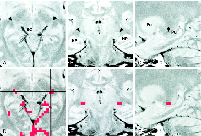 fig 2.